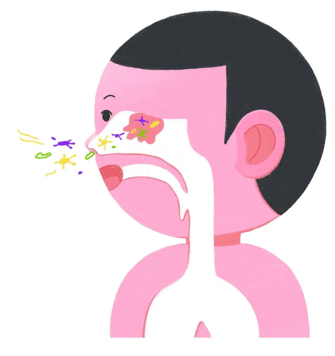 擤鼻涕会造成中耳炎吗 (擤鼻涕会造成鼓膜穿孔吗 擤鼻涕鼓膜穿孔怎么办)